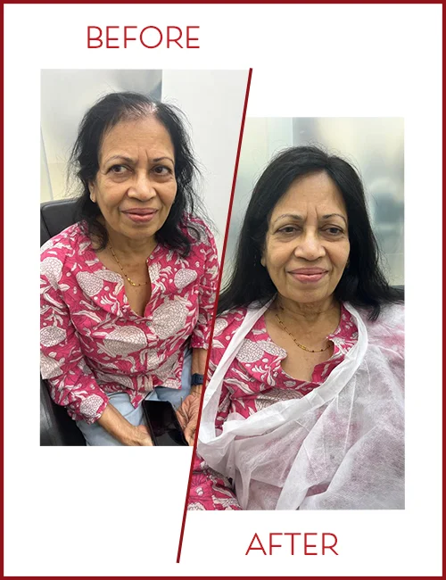 Hair wigs for women in Mumbai