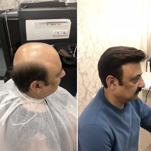 Monofilament Wigs for Men