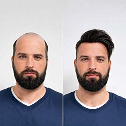 Hair Weaving for Men