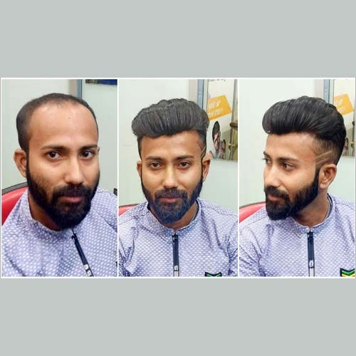 Clip on Hair System in Mumbai for Men