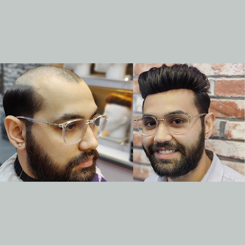 Hair Bonding in Mumbai for Men